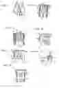 Fig. 04 - Piston, cylinder and piston assembly and piston ring for a piston