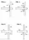 Fig. 03 - DEVICES AND METHODS TO MAINTAIN THE PATENCY OF AN OPENING RELATIVE TO PARENCHYMAL TISSUE OF THE LUNG
