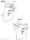 Fig. 04 - DEVICES AND METHODS TO MAINTAIN THE PATENCY OF AN OPENING RELATIVE TO PARENCHYMAL TISSUE OF THE LUNG