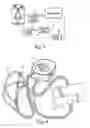 Fig. 03 - Ventless mask CPAP system