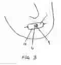 Fig. 03 - Respiratory devices