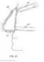 Fig. 22 - Respiratory devices