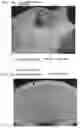 Fig. 09 - MOLD AND MANUFACTURING METHOD THEREOF, AND MOLDED ARTICLE USING THE MOLD