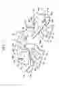 Fig. 04 - Disk brake