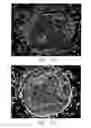 Fig. 08 - Process for cathodic protection of electrode material