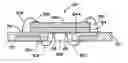 Fig. 01 - Integrated circuit package having reduced interconnects