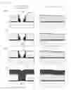 Fig. 17 - Perpendicular magnetic recording head having a magnetic layer overhanging a trailing side of a main pole and method of manufacture thereof