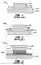 Fig. 02 - Method and structure for creation of a metal insulator metal capacitor