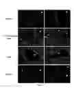 Fig. 02 - Methods and compositions for treating autoimmune diseases
