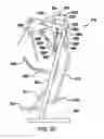 Fig. 14 - Exercise device