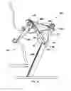 Fig. 31 - Exercise device