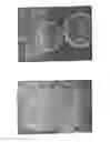 Fig. 06 - Polymer-based sustained release device