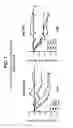 Fig. 02 - METHODS OF REDUCING SMALL, DENSE LDL PARTICLES