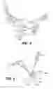 Fig. 04 - Mathematical relationship of strain, neurological dysfunction and abnormal behavior resulting from neurological dysfunction of the brainstem