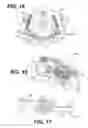 Fig. 10 - Mathematical relationship of strain, neurological dysfunction and abnormal behavior resulting from neurological dysfunction of the brainstem