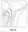 Fig. 33 - Mathematical relationship of strain, neurological dysfunction and abnormal behavior resulting from neurological dysfunction of the brainstem
