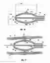 Fig. 07 - Method for delivering medication into an arterial wall for prevention of restenosis