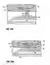 Fig. 08 - Method for delivering medication into an arterial wall for prevention of restenosis