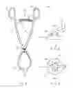 Fig. 02 - Skin-Bone Clamp