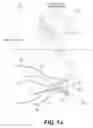 Fig. 02 - NERVE REGENERATION SYSTEM AND LEAD DEVICES ASSOCIATED THEREWITH