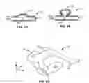 Fig. 02 - DEVICES AND METHODS FOR ACCESSING AND TREATING AN ANEURYSM