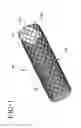 Fig. 02 - Stent-graft with bioabsorbable structural support