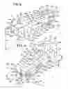 Fig. 03 - Prosthetic implant with biplanar angulation and compound angles