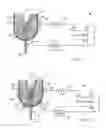 Fig. 02 - OSSEOINTEGRATED IMPLANT WITH ELECTRICAL STIMULATION