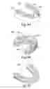Fig. 08 - Local enforcement of accuracy in fabricated models