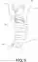 Fig. 06 - Leg sock for horses