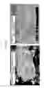 Fig. 07 - METHOD OF PRODUCING NITRIDE/TUNGSTEN NANOCOMPOSITE POWDER AND NITRIDE/TUNGSTEN NANOCOMPOSITE POWDER PRODUCED USING THE SAME