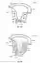 Fig. 22 - Liquid flow control and beverage preparation apparatuses, methods and systems