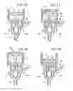 Fig. 06 - Machine for brewing a beverage such as coffee and related method