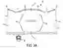 Fig. 06 - Dual harness routing devices