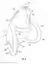 Fig. 04 - Infant drinking cup