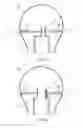 Fig. 02 - Luminaire with eccentric channel design