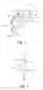 Fig. 02 - System to identify viscosity of aspirated material during ophthalmic surgery