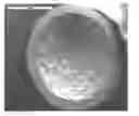 Fig. 01 - Composite metal foam and methods of preparation thereof