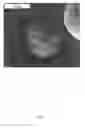 Fig. 04 - Composite metal foam and methods of preparation thereof