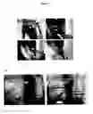 Fig. 02 - Compositions and Methods for Treating Peripheral Vascular Diseases