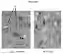 Fig. 01 - Enhancing the effect of therapeutic proteins on the central nervous system