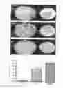 Fig. 02 - Extract of the family dioscoreaceae and composition for preventing or treating peripheral neuropathy comprising the same