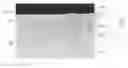 Fig. 01 - Wear component with a carburized case