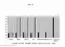 Fig. 06 - Proteinase K inhibitors, methods and compositions therefor