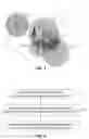 Fig. 02 - Method of determining a location of a mobile device and method of managing a list for use in such a method