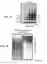 Fig. 09 - DIAGNOSTIC METHOD BASED ON LARGE SCALE IDENTIFICATION OF POST-TRANSLATIONAL MODIFICATION OF PROTEINS