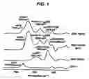 Fig. 02 - Metal Ion-Based Immobilization