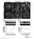 Fig. 02 - TREATING PANCREATITIS