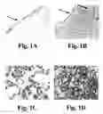 Fig. 02 - MATERIALS AND METHODS FOR DETECTING AND TREATING PERITONEAL OVARIAN TUMOR DISSEMINATION INVOLVING TISSUE TRANSGLUTAMINASE