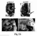 Fig. 07 - MATERIALS AND METHODS FOR DETECTING AND TREATING PERITONEAL OVARIAN TUMOR DISSEMINATION INVOLVING TISSUE TRANSGLUTAMINASE